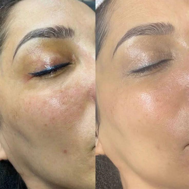 Before and After Comparison